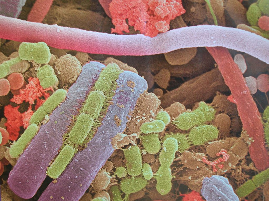 Científicos buscan entender el “microbioma” bacteriano