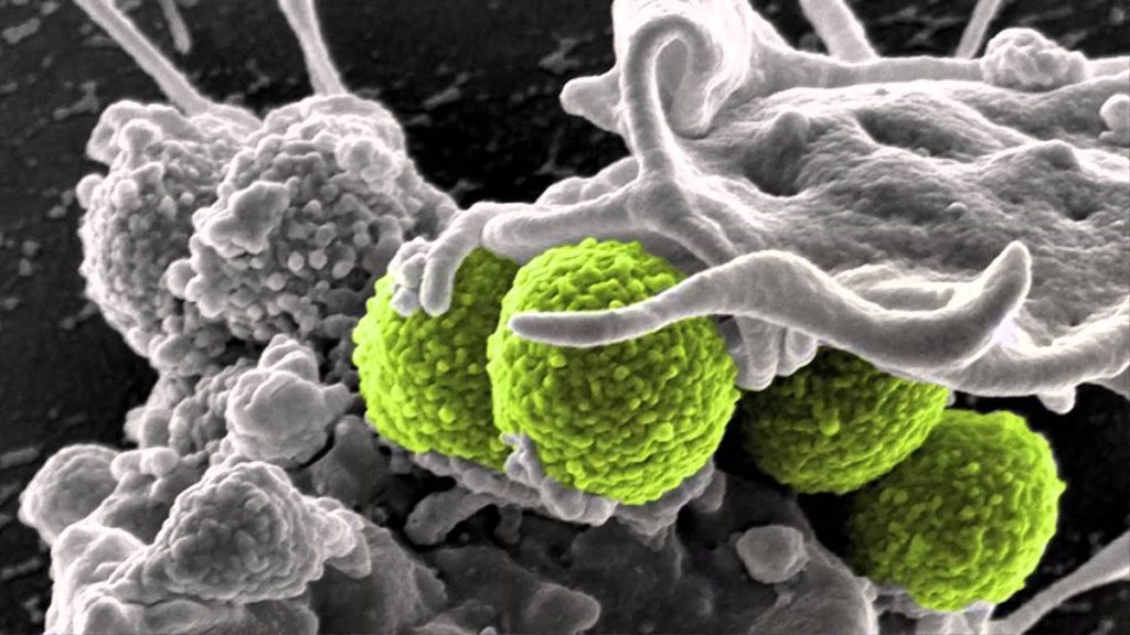 Superbacterias podrían matar a una persona cada tres segundos en 2050