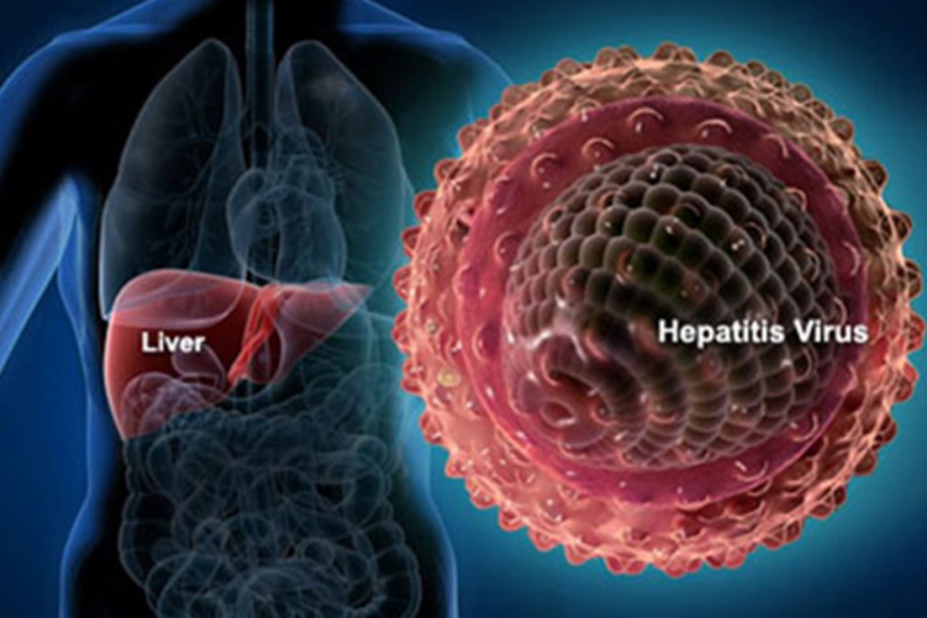 Hepatitis, principal causa de muerte en el mundo