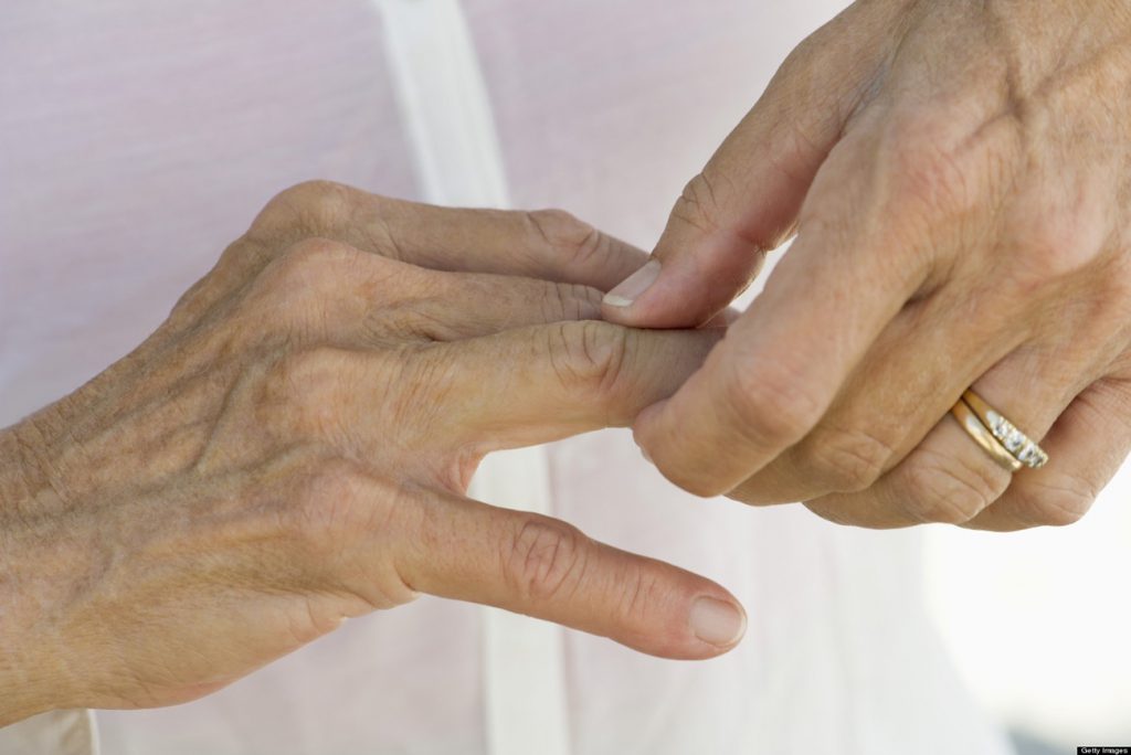 Mexicanos víctimas de artritis reumatoide