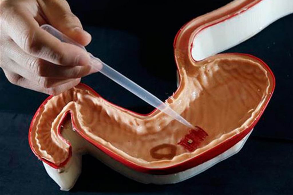 (video) “Robot origami”; es digerible y ayudaría a suministrar fármacos