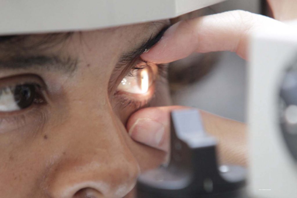 Con sensor intraocular detectan glaucoma