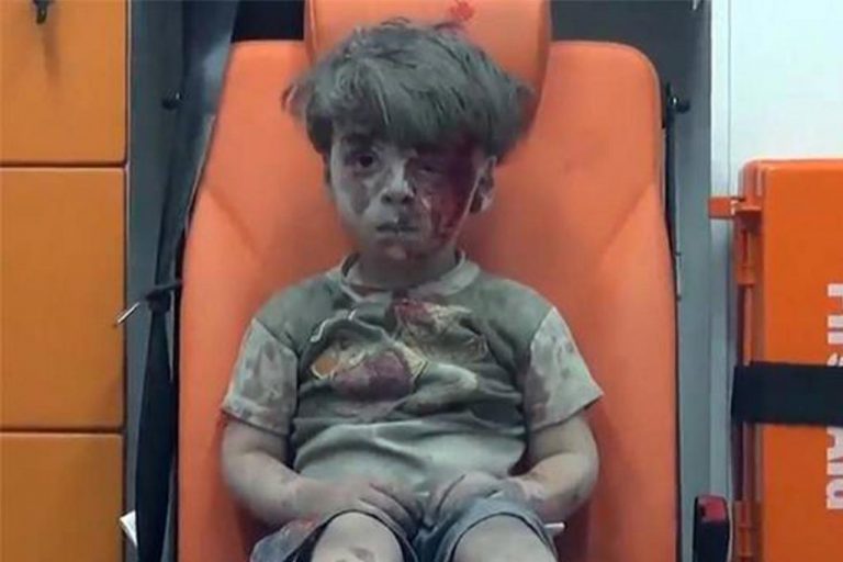 niño sirio herido en alepo