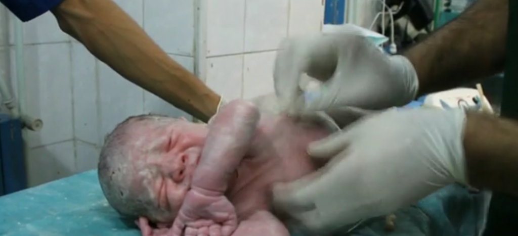 Bebé nace en medio de la guerra en Aleppo