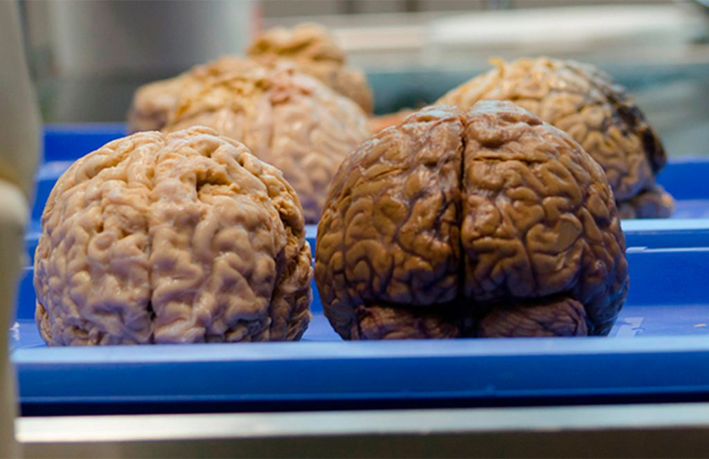 (Video) Bélgica recibe la mayor colección de cerebros
