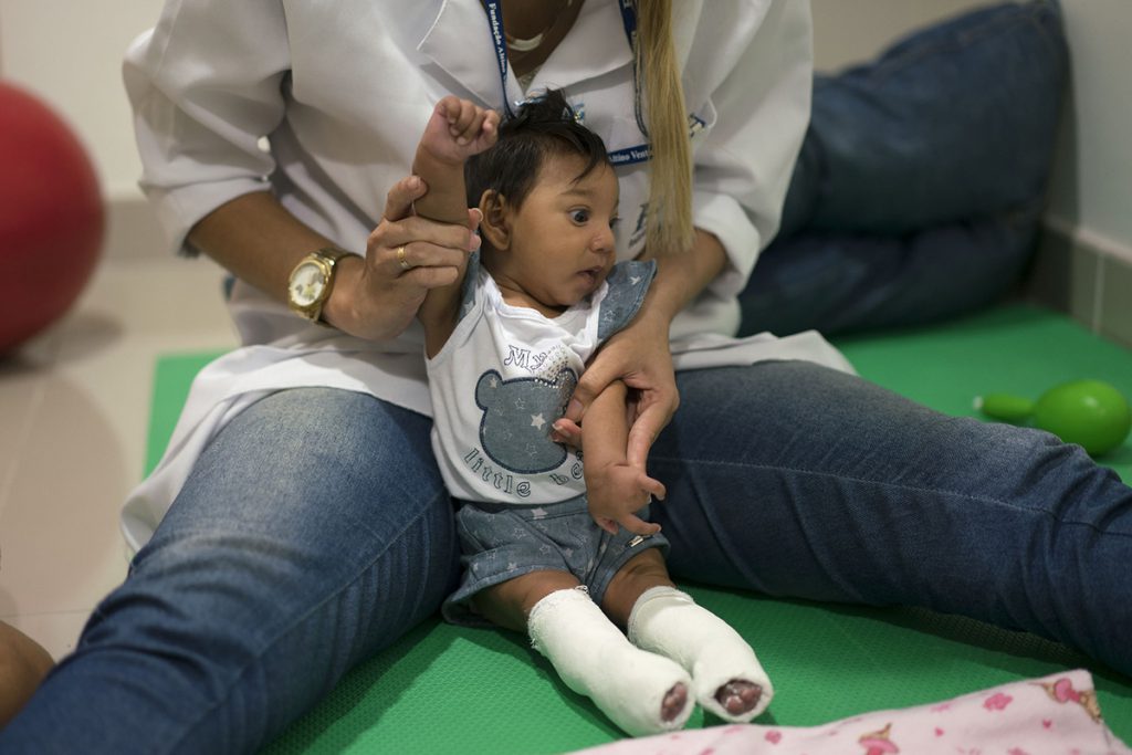 El Zika produce algo más que microcefalia en los bebés