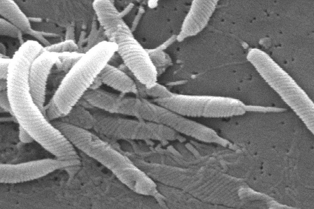 Bacteria helicobacter pylori, cuáles los síntomas