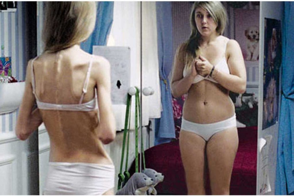 Anorexia y bulimia puede afectar a mujeres maduras