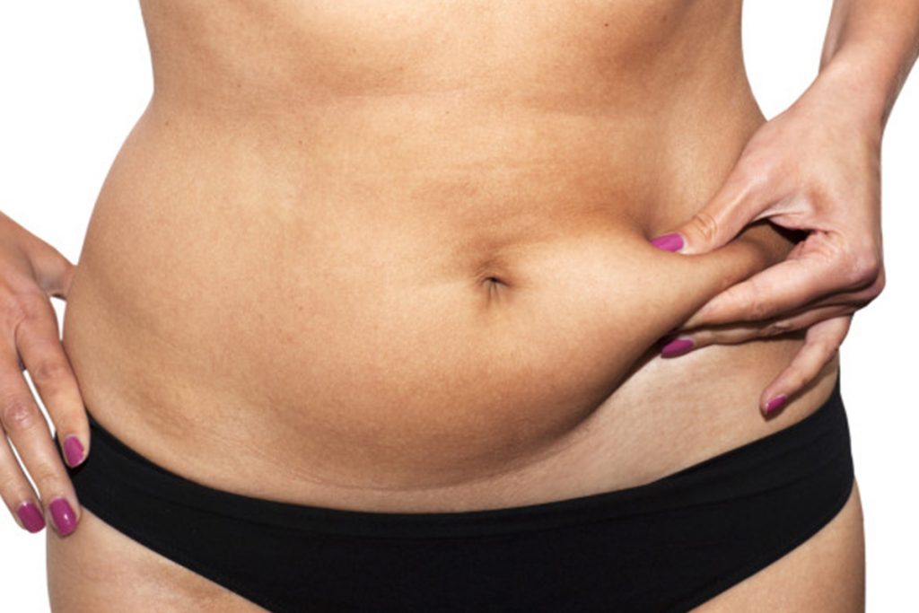 La grasa en el abdomen puede aumentar el riesgo de diabetes