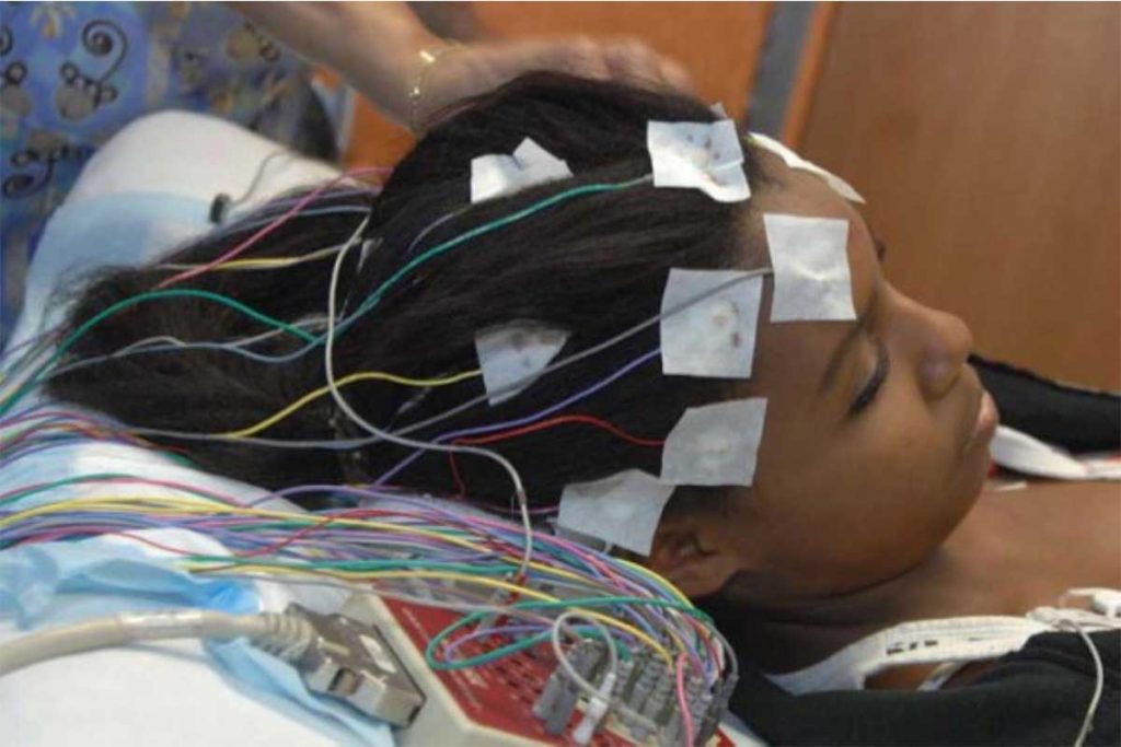 Dispositivo ayuda a pacientes con epilepsia