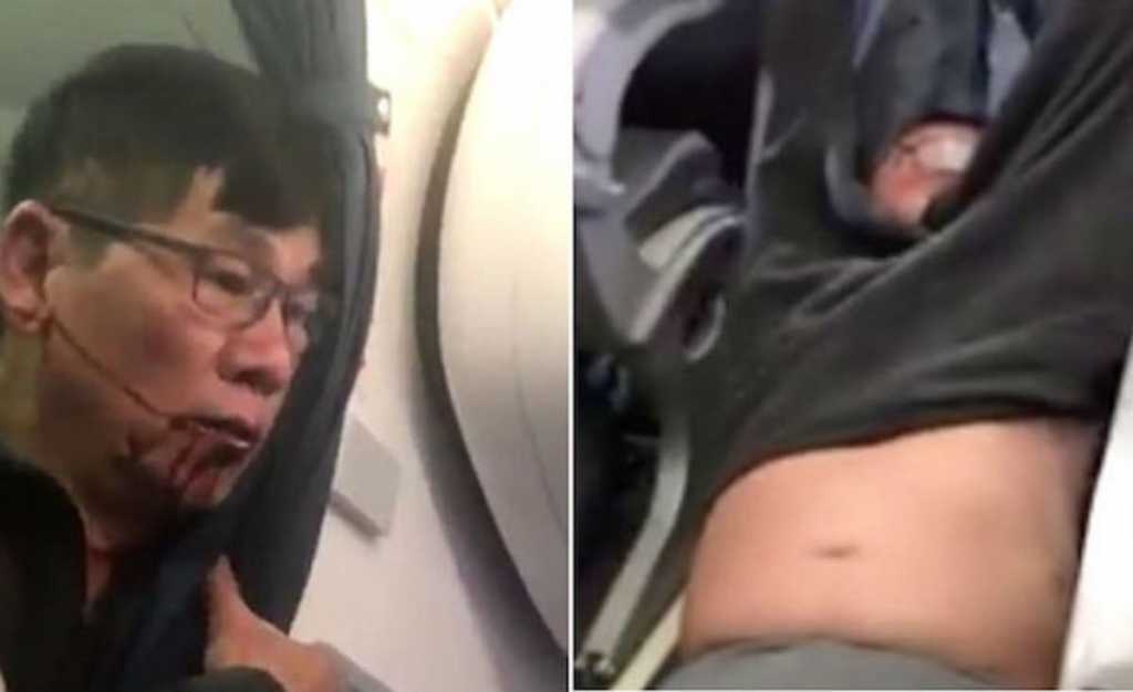 Pasajero expulsado de vuelo demanda a United Airlines