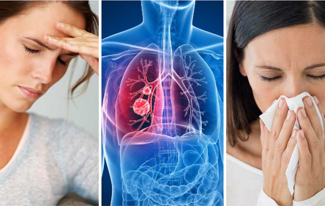 Estudio revela que inmunoterapia eleva supervivencia al cáncer de pulmón