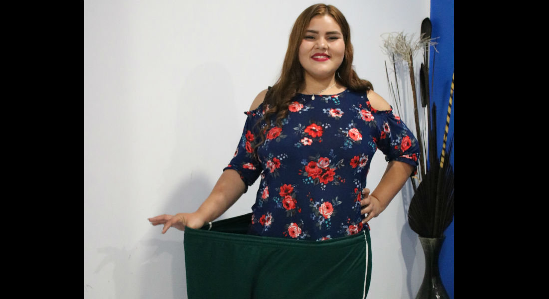 Mexicana busca llegar a su peso ideal tras bajar 105 kilos