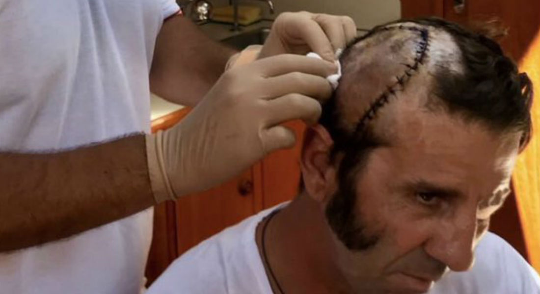 VIDEO: Captan instante en el que torero pierde el cuero cabelludo