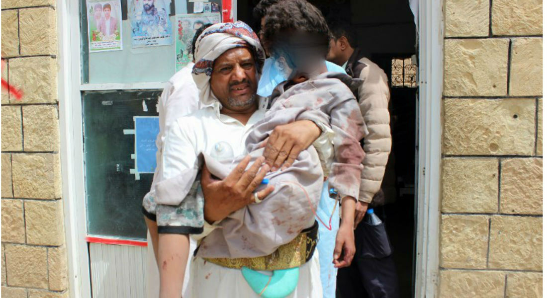 La hambruna mata a niños en Yemen, asolado por la guerra