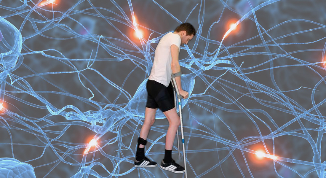 ¡Nueva esperanza! Parapléjicos logran caminar con revolucionario tratamiento