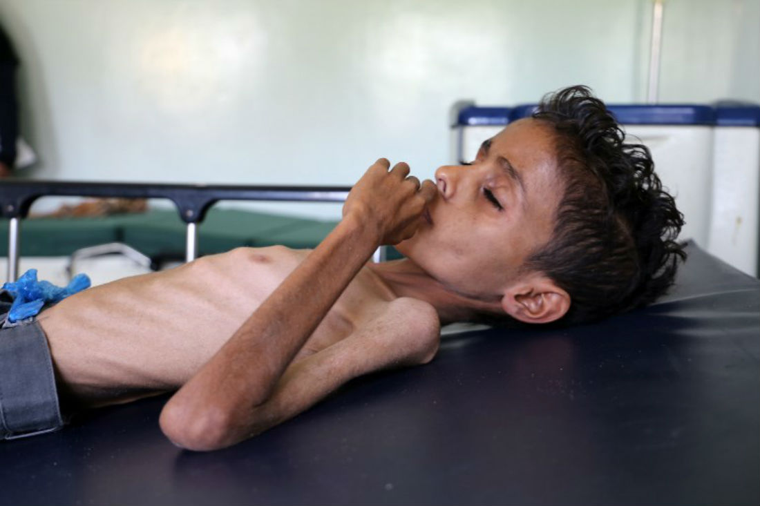 Yemen está al borde del colapso. La hambruna es inminente