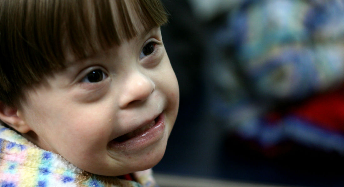 ¡Hermosa historia! Hombre soltero adopta a bebé con síndrome de Down