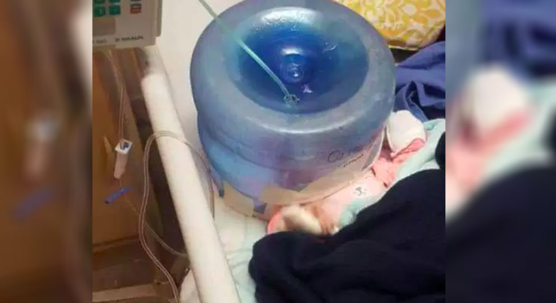 Con garrafón improvisan incubadora en hospital de Magdalena en Sonora