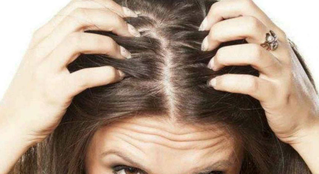 ¡Cuida tu cabello!, el estrés y la ansiedad podrían dejarte calva