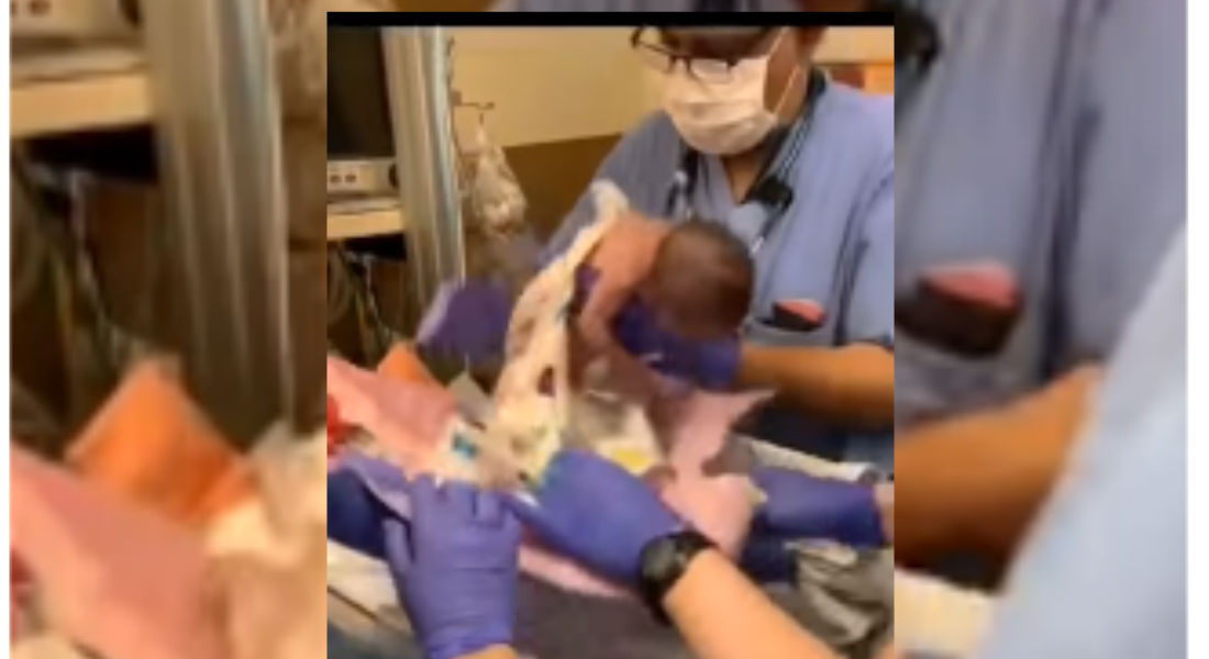 VIDEO: ¡Indignante! Médico deja caer a bebé recién nacida