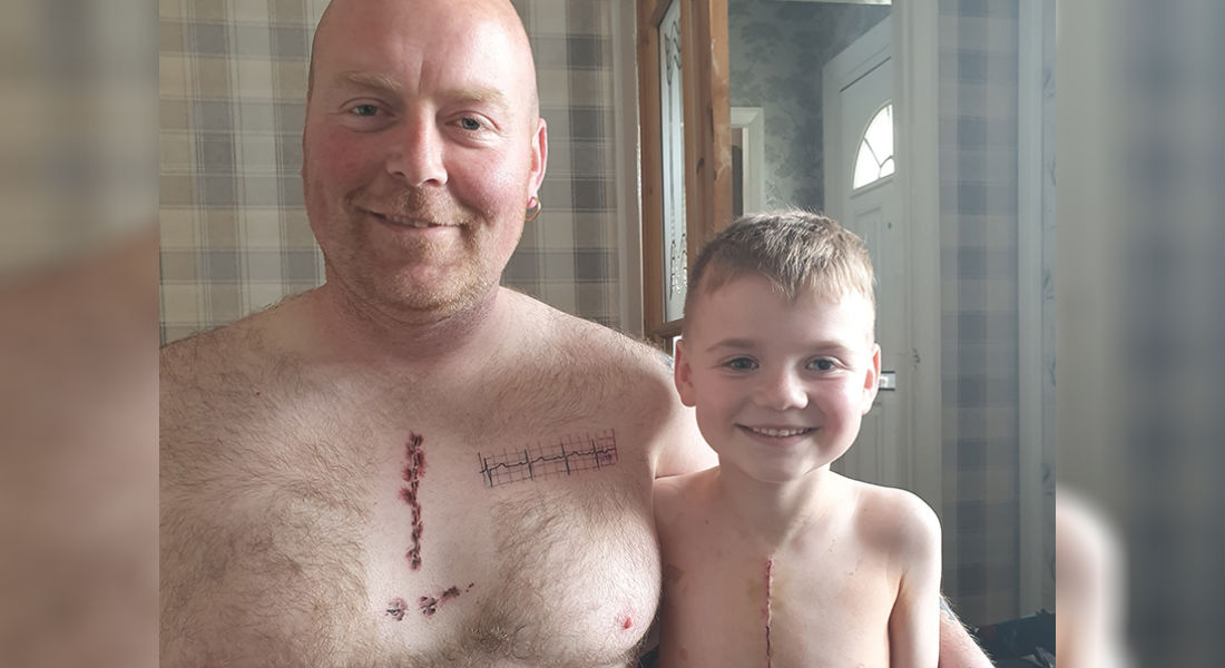 En apoyo, padre se tatúa la misma cicatriz que su hijo