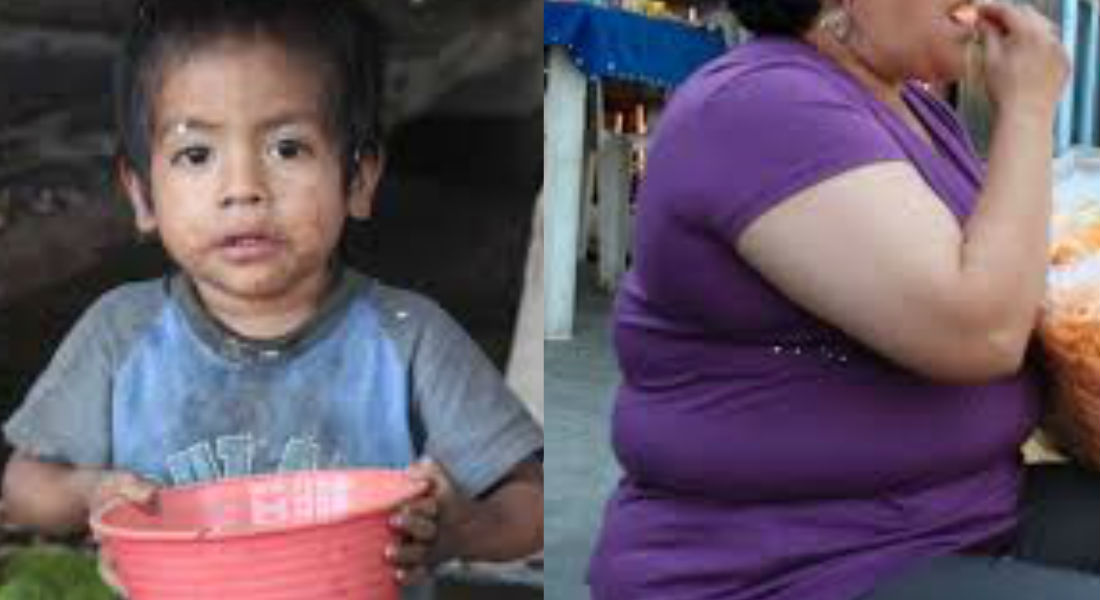 Historia de dos mundos; desnutrición y obesidad afecta a millones de personas