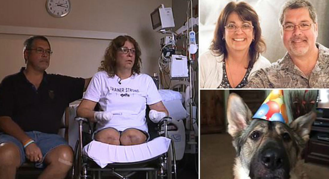 Mujer pierde brazos y piernas luego de que su perro la lamiera