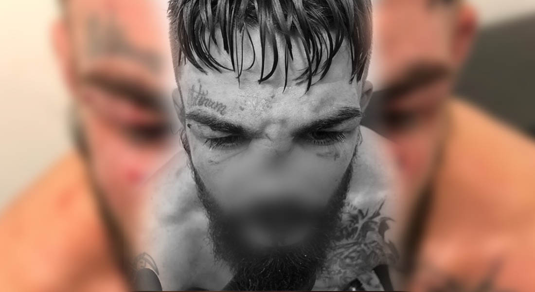VIDEO: Es escalofriante cómo quedó la nariz de Mike Perry tras pelea de UFC
