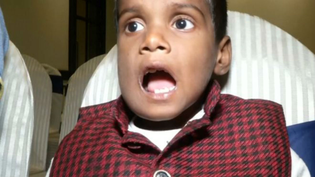 Fotos: ¡Insólito! A un niño de 7 años le quitaron 526 dientes