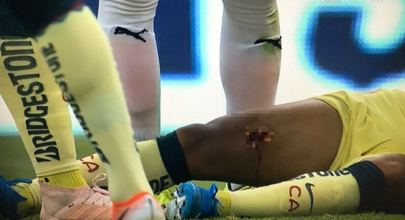 VIDEO: Giovani Dos Santo sufre terrible lesión tras violenta entrada de Briseño