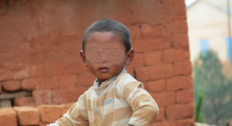 900 niños sufren de VHI; pediatra los inyectaba con jeringas usadas