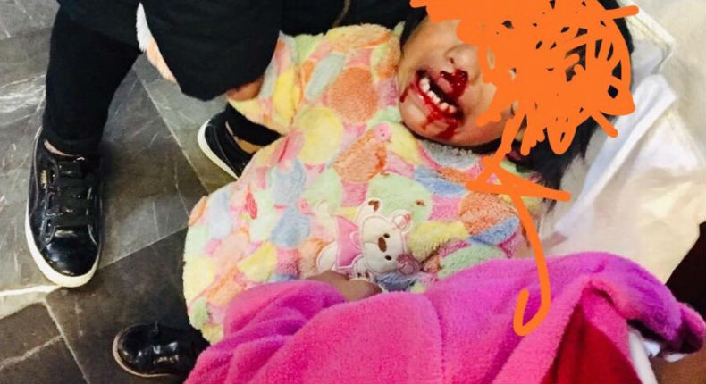 Mujer golpea brutalmente a su hija de dos años en el Metro Candelaria