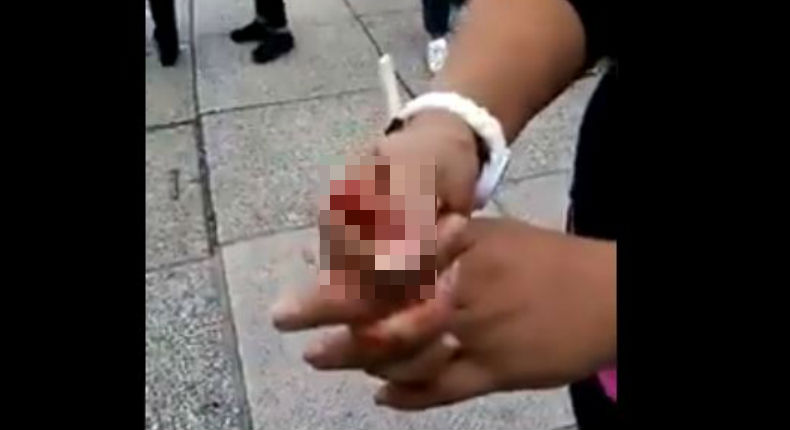 VIDEO: Policías cortan el dedo de una vendedora en enfrentamiento